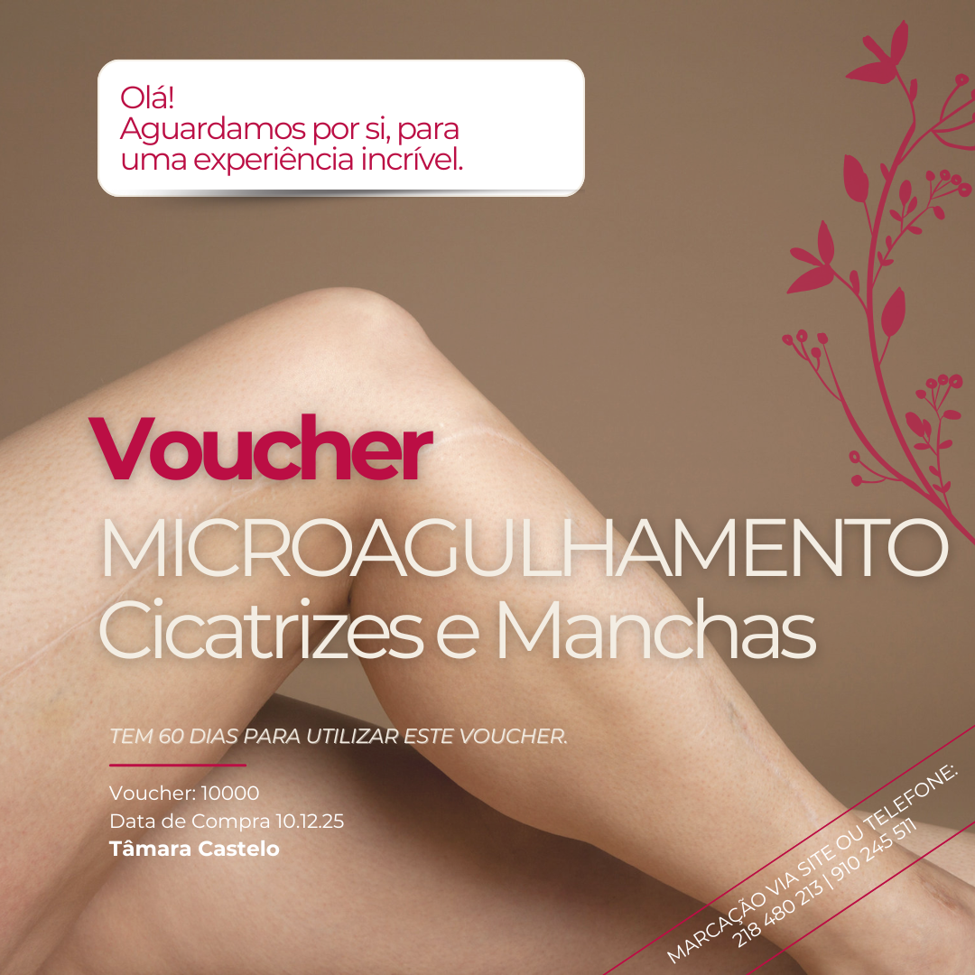 MICROAGULHAMENTO Cicatrizes e manchas